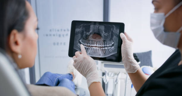 Licensed Dental Implants service in Athens, TX - Smile Center Dentistry